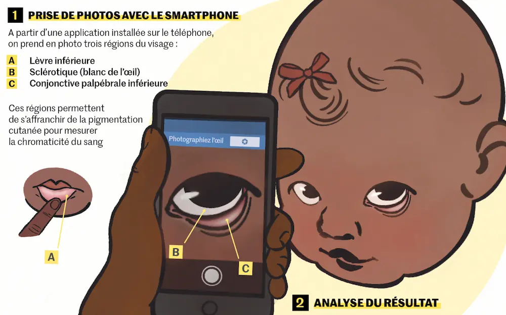 An infographic produced by Le Monde, showing a smartphone taking an image of the eye of a child.